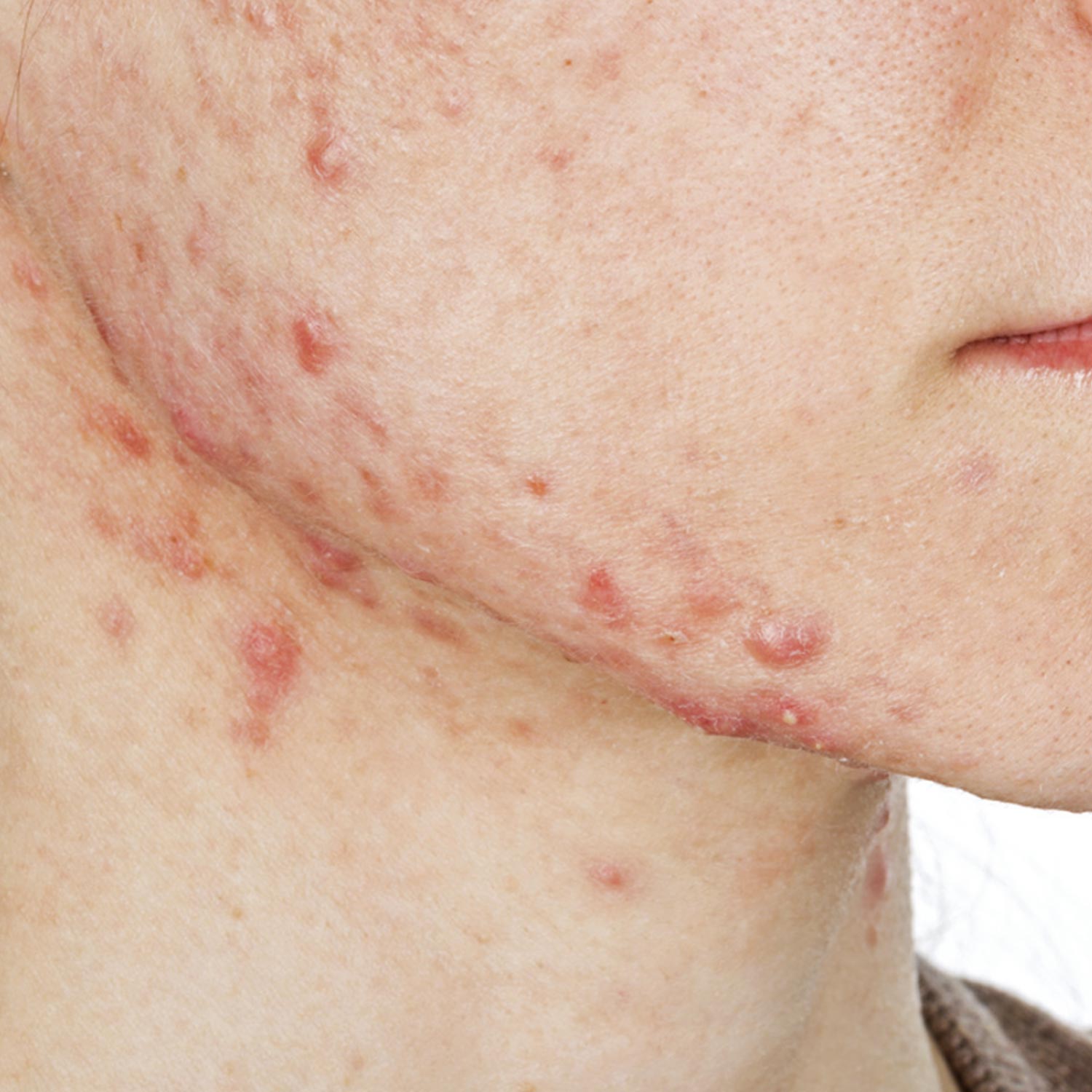 Renophase Renewpeel Gel Nettoyant