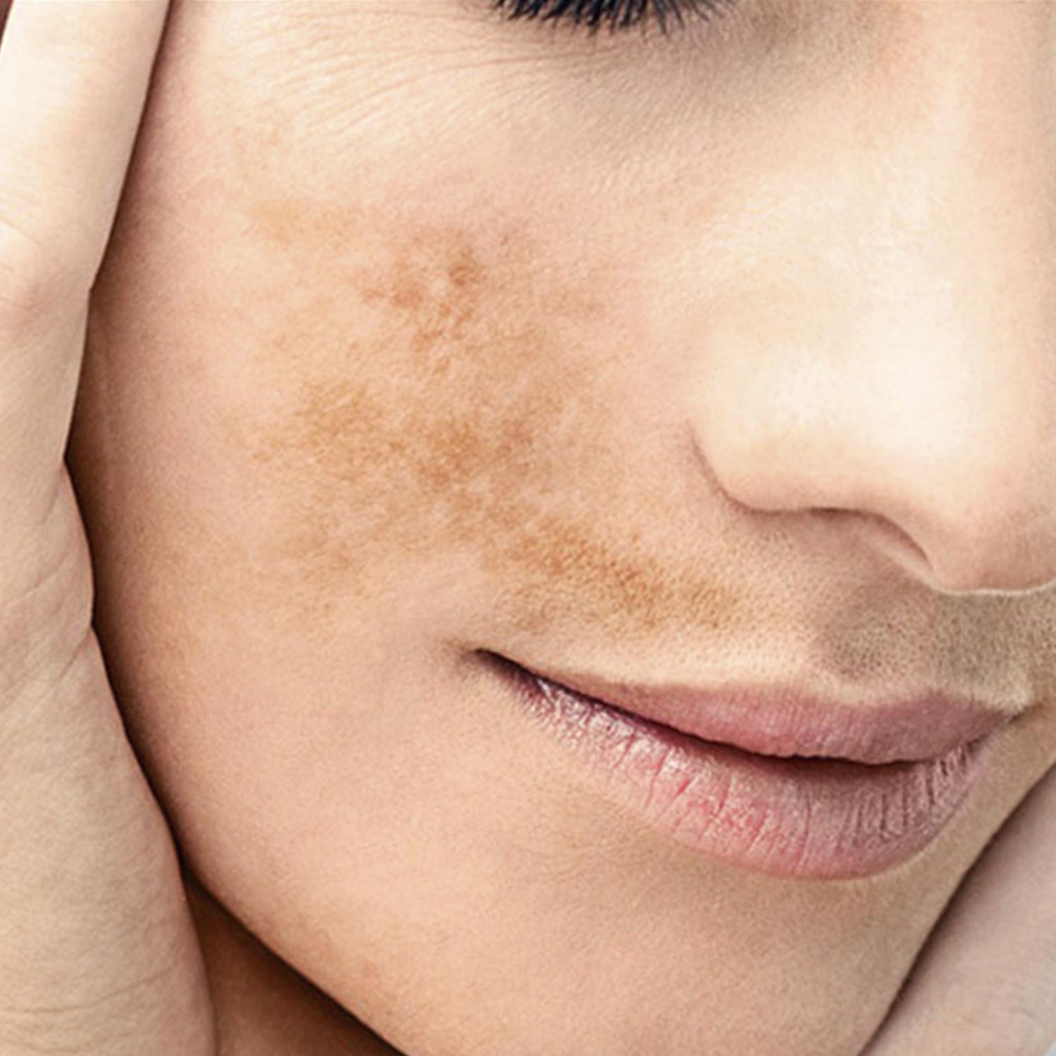 Renophase Renewpeel Crème 10