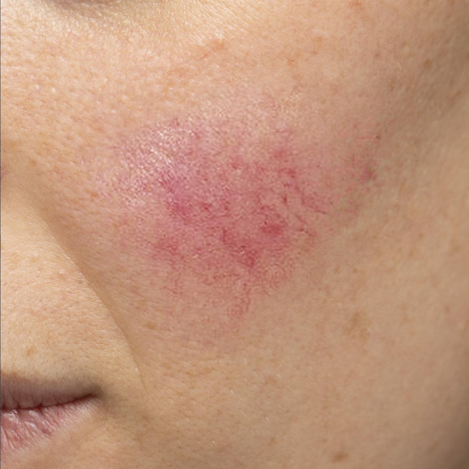 Renophase Skinbiotic Fluide